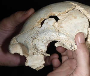 Parte del cráneo adulto hallado en Atapuerca (Burgos). Las partes más pequeñas se montarán en el laboratorio. Puede ser una de las piezas más completas encontradas hasta ahora.- Javier Trueba / Madrid Scientific Films
