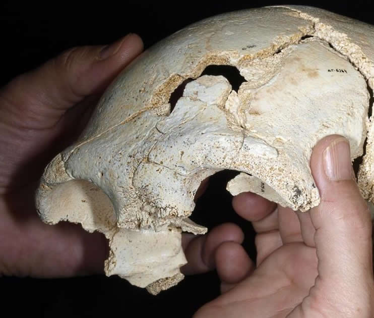 Parte del cráneo adulto hallado en Atapuerca (Burgos). Las partes más pequeñas se montarán en el laboratorio. Puede ser una de las piezas más completas encontradas hasta ahora.- Javier Trueba / Madrid Scientific Films ORDOÑEZ / REUTERS