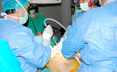 Imagen de archivo de una operación de laparoscopia tradicional en Medina del Campo. | M. A. Rodríguez