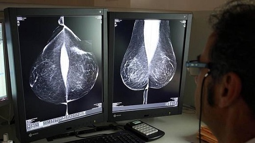 Estudio una mamografía digital, en el servicio de mamografías del Hospital Río Hortega de Valladolid. / ICAL